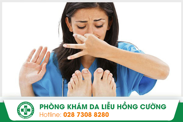 Nguyên nhân và triệu chứng của bệnh hôi chân và cách điều trị