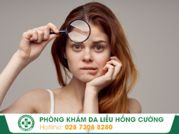 Chữa bệnh ngoài da ở đâu hiệu quả?