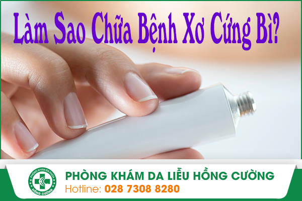 Làm Sao Chữa Bệnh Xơ Cứng Bì?