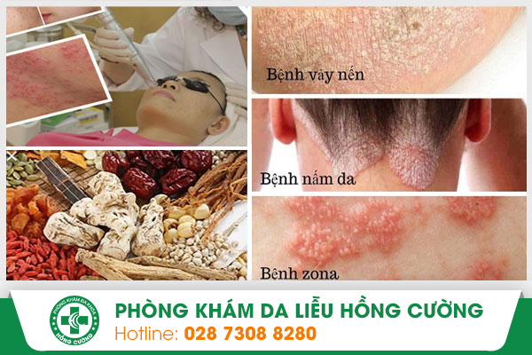 Phòng khám da liễu đông tây y kết hợp uy tín nhất hiện nay