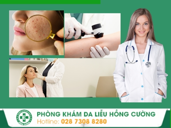 Khắc phục hiệu quả các bệnh về da tại Phòng Khám Da Liễu Hồng Cường