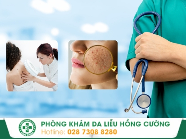 Địa chỉ phòng khám da liễu quận 5 uy tín và hiệu quả