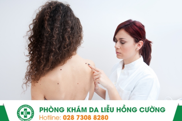 Phòng khám da liễu quận 7 nào là hiệu quả?