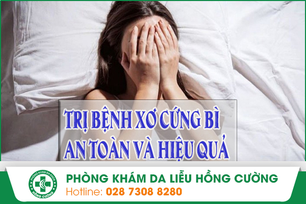 Trị Bệnh Xơ Cứng Bì An Toàn Và Hiệu Quả