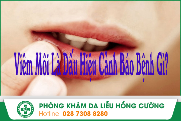 Viêm Môi Là Dấu Hiệu Cảnh Báo Bệnh Gì?