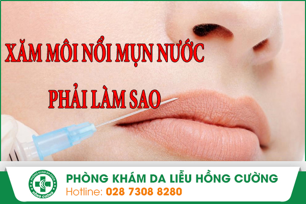 Xăm Môi Bị Nổi Mụn Nước Phải Làm Sao?