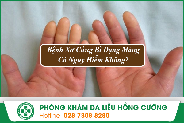 Bệnh Xơ Cứng Bì Dạng Mảng Có Nguy Hiểm Không?