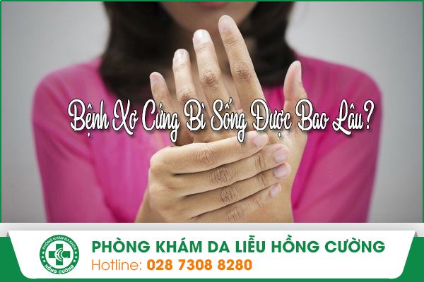 Bệnh Xơ Cứng Bì Sống Được Bao Lâu?